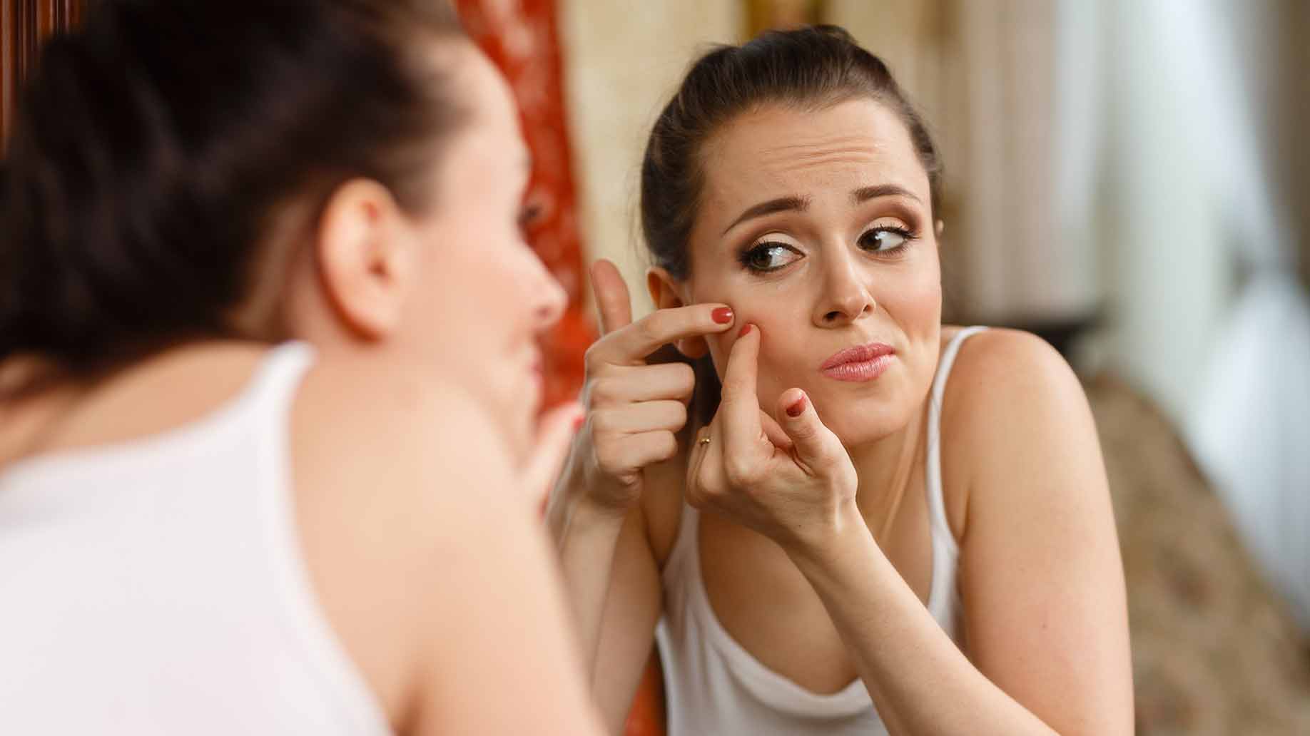 acne pimples hormones red swollen painful bump pus natural remedies