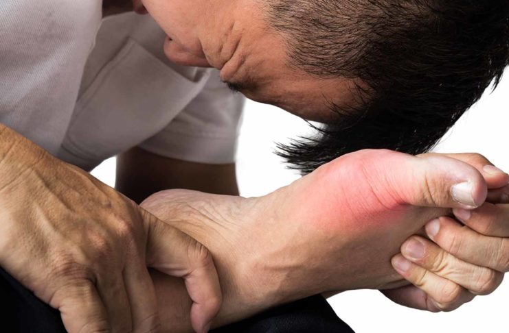 gout pain toe arthritis inflammation natural remedies